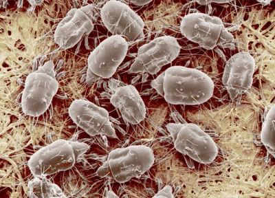microscopic view of house dustmites