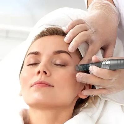 Microneedling in parkland florida