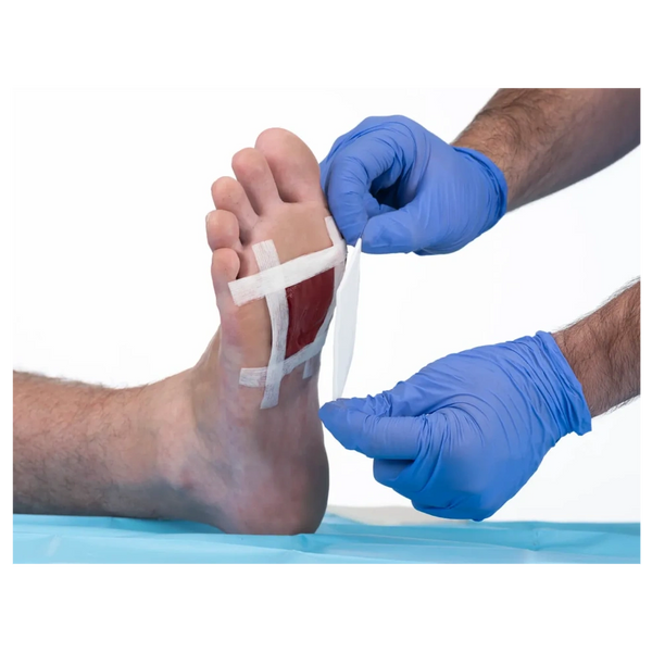 Person with blue gloves removing a bandage from a bleeding wound on the foot.