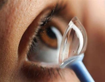 Scleral lenses
