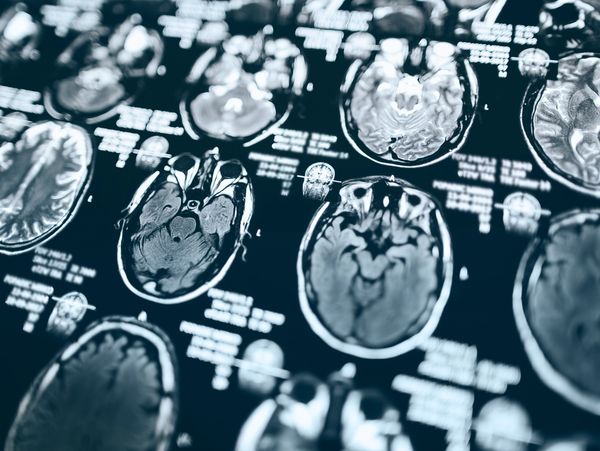 Brain scan imagery. A medical document showing many images of a brain and skull.