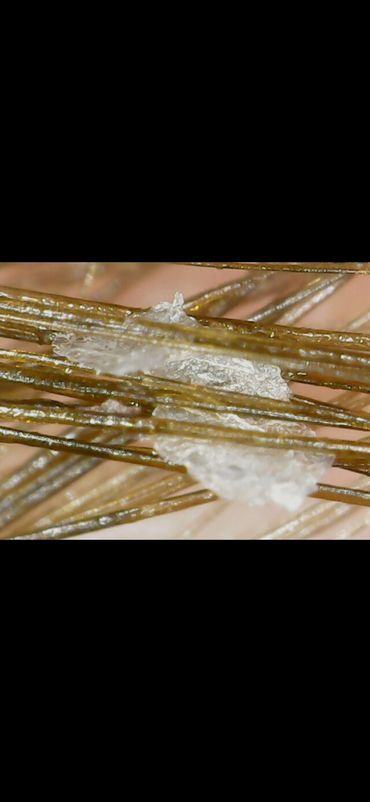 Skin build up on scalp before head spa.