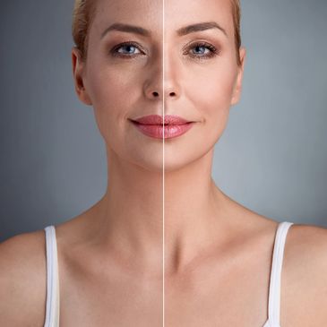 Woman's face with one side showing wrinkles and the other side smooth.