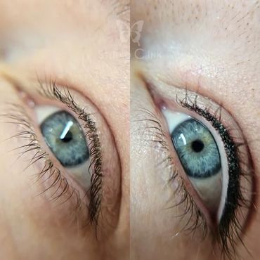 Close-up of a blue eye before and after applying permanent eyeliner tattoo.