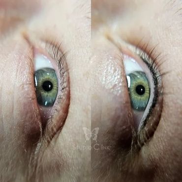 Close-up of a green eye before and after cosmetic enhancement.