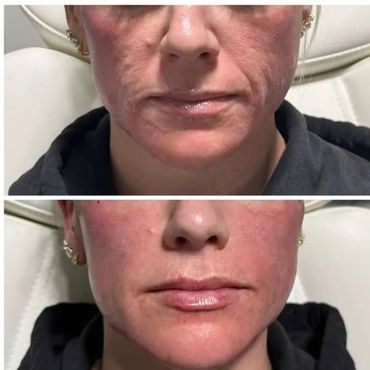 Before and after images showing facial skin improvement and reduced wrinkles.
