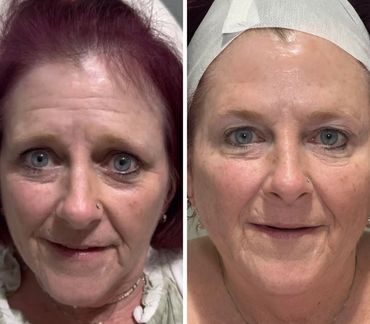 Side-by-side close-ups of a woman showing facial skin texture and features.