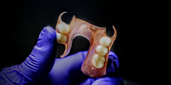 Flexible partial Dentures