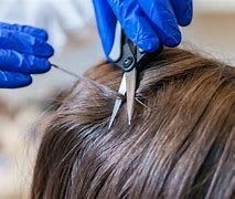 Diagnostic Hair Testing