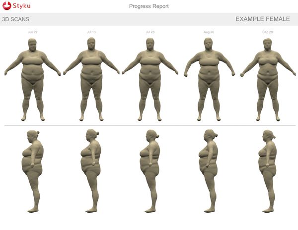 Miracle Medical Weight Loss