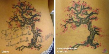 before and after photo of a quote tattoo on a Sakura tree