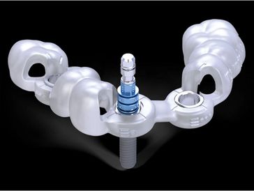 Surgical guide for safe dental implant placement