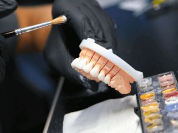 Dental lab technician designing laminate porcelain veneers