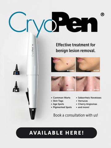 CryoPen for benign lesion removal with before and after results.