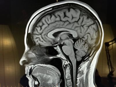 Résonance Magnétique