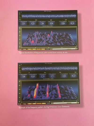 Figure démonstrative des effets de la Lucia Light No 3 , montre un motif d'harmonisation croissante