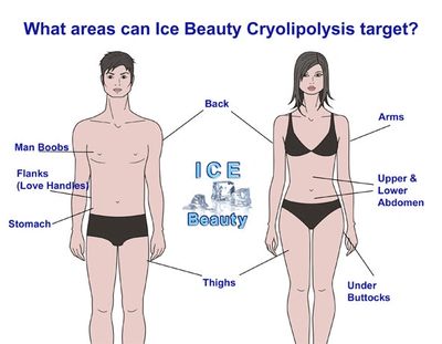 Fat freezing cryolipolysis Somerset, Devon and Cornwall