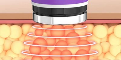 Cavitation fat loss and lymphatic drainage cool sculpting devon and somerset