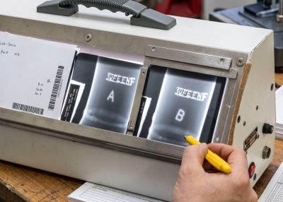 Hand examining X-ray images on a lightbox with a yellow pen.