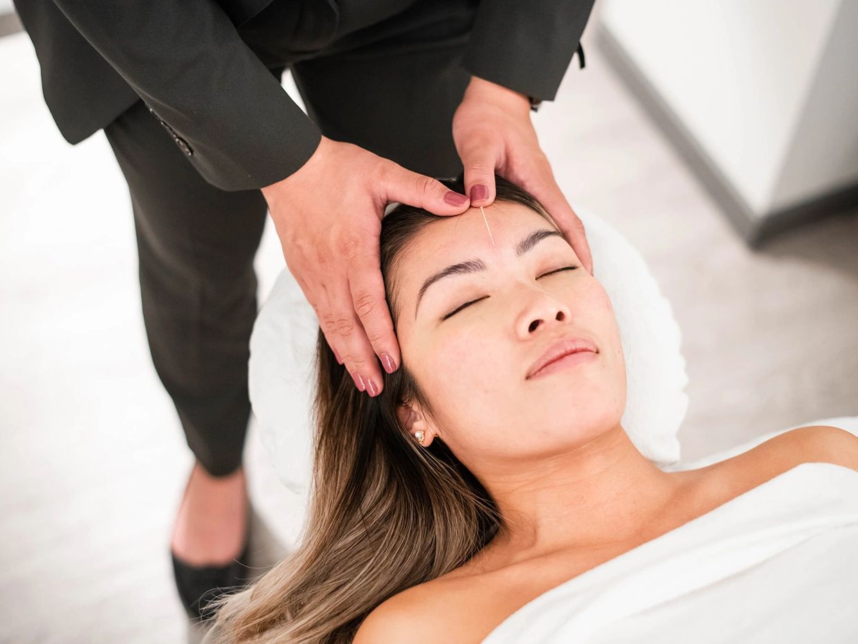 Woman receiving acupuncture on her forehead with closed eyes.