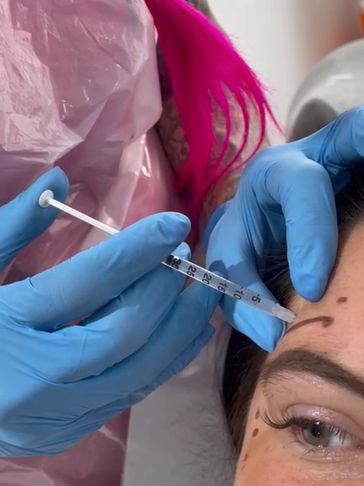 Anti wrinkle Botox injection