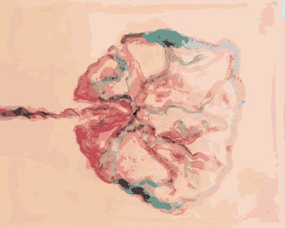 Fargo Moorhead Red River Valley Birth Doula