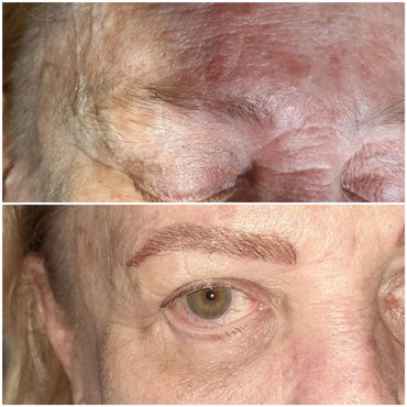 a very mature skin client with scars in the brows getting a PMU service in brentwood tn