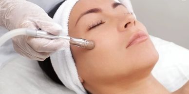 a person applying a Microdermabrasion  on the face of a woman