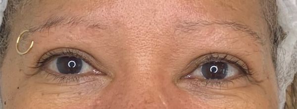 Before top inner eyeliner