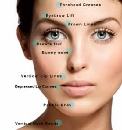 Botox, Xeomin, Jeauveau, and Dysport has multiple uses on the face and neck. Aesthetic Injectable