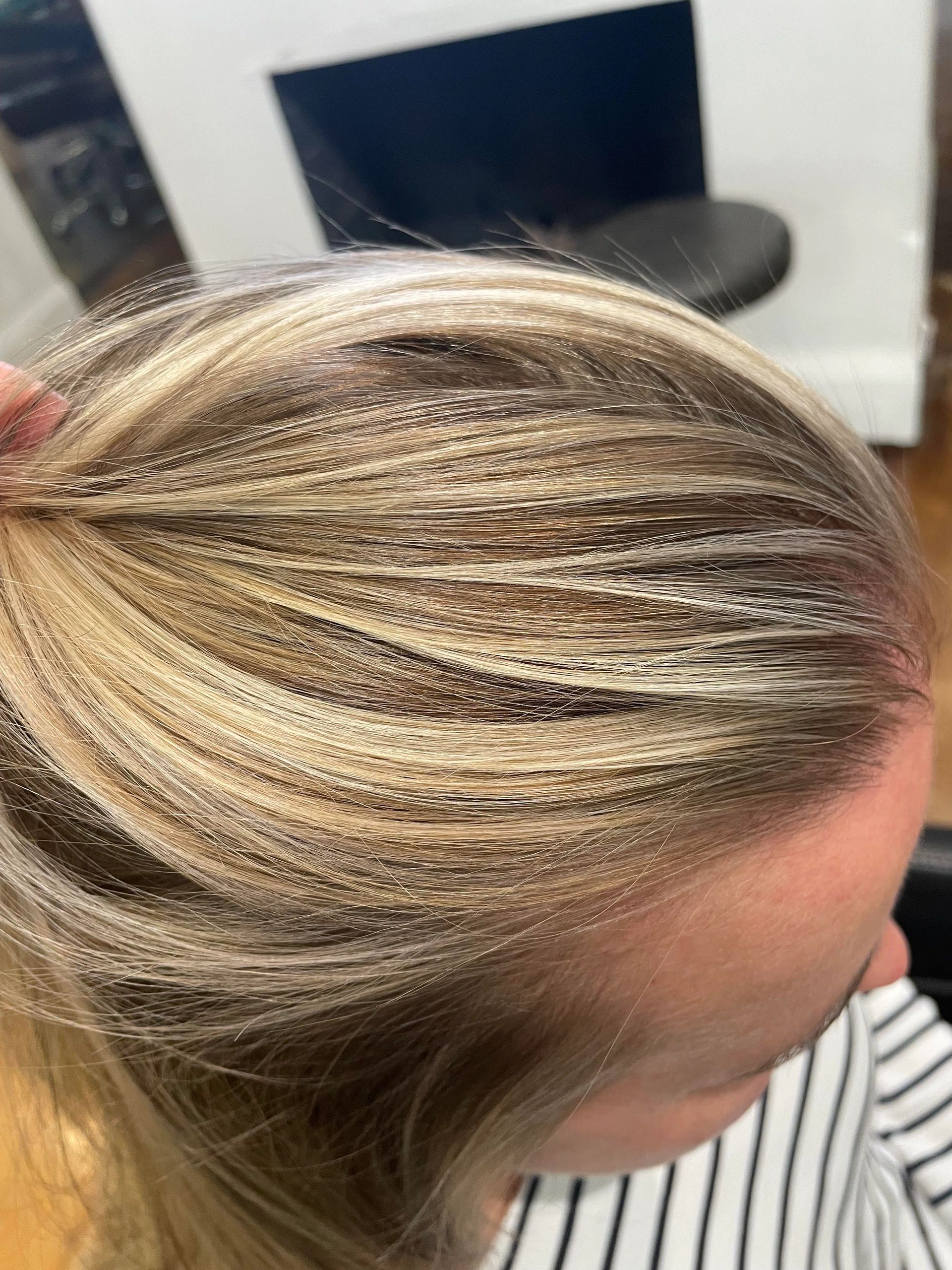 Front View of Hairline