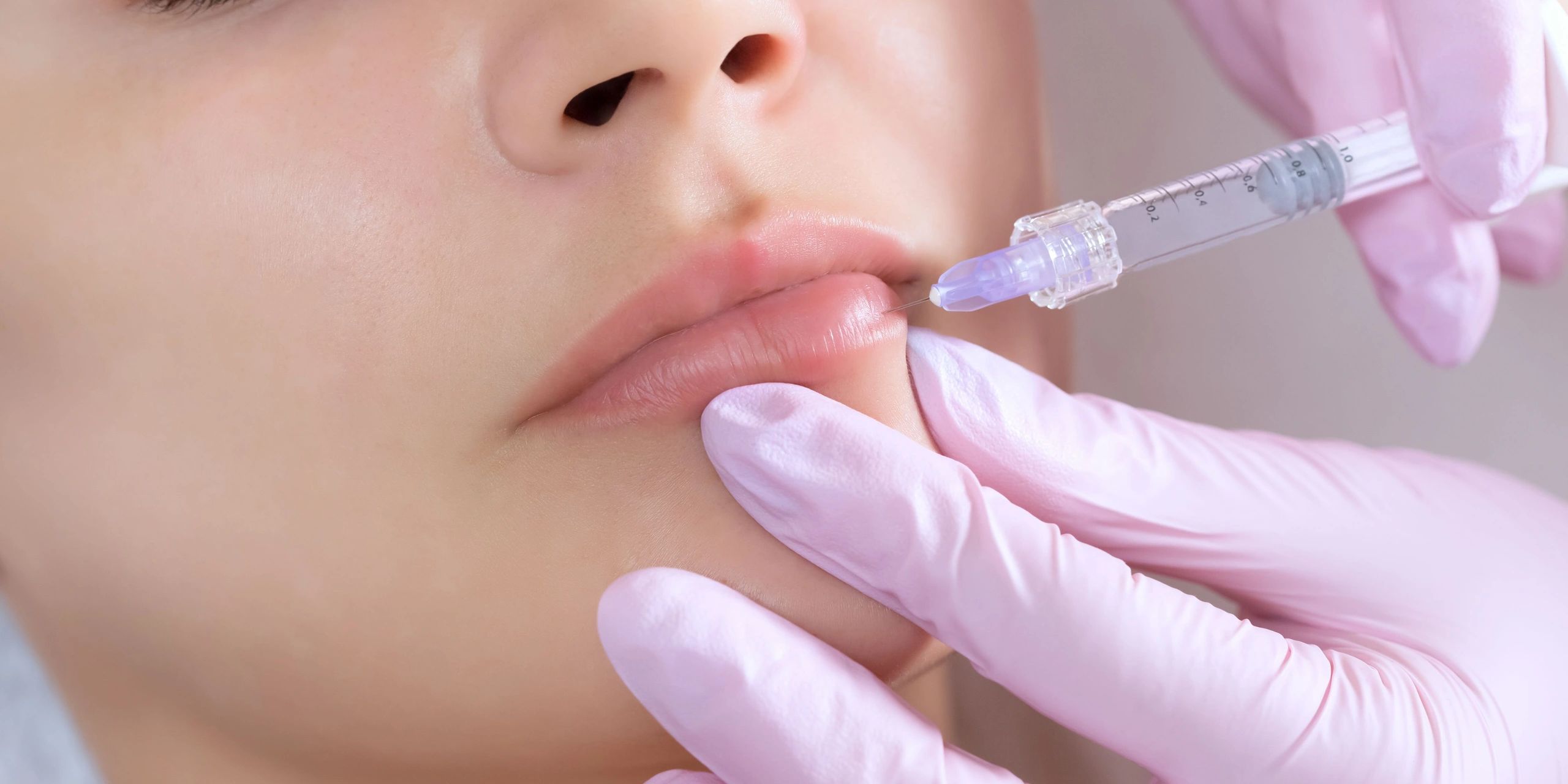 dermal fillers in gravesend