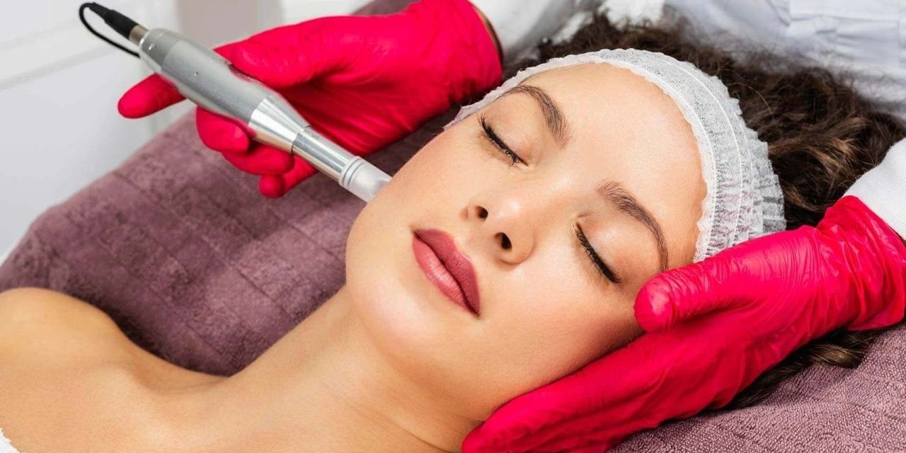 microneedling in gravesend