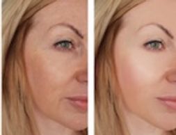 Premium Plus Anti-Aging bundle of treatments