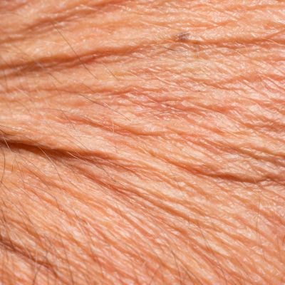 a close up of crepey skin on face