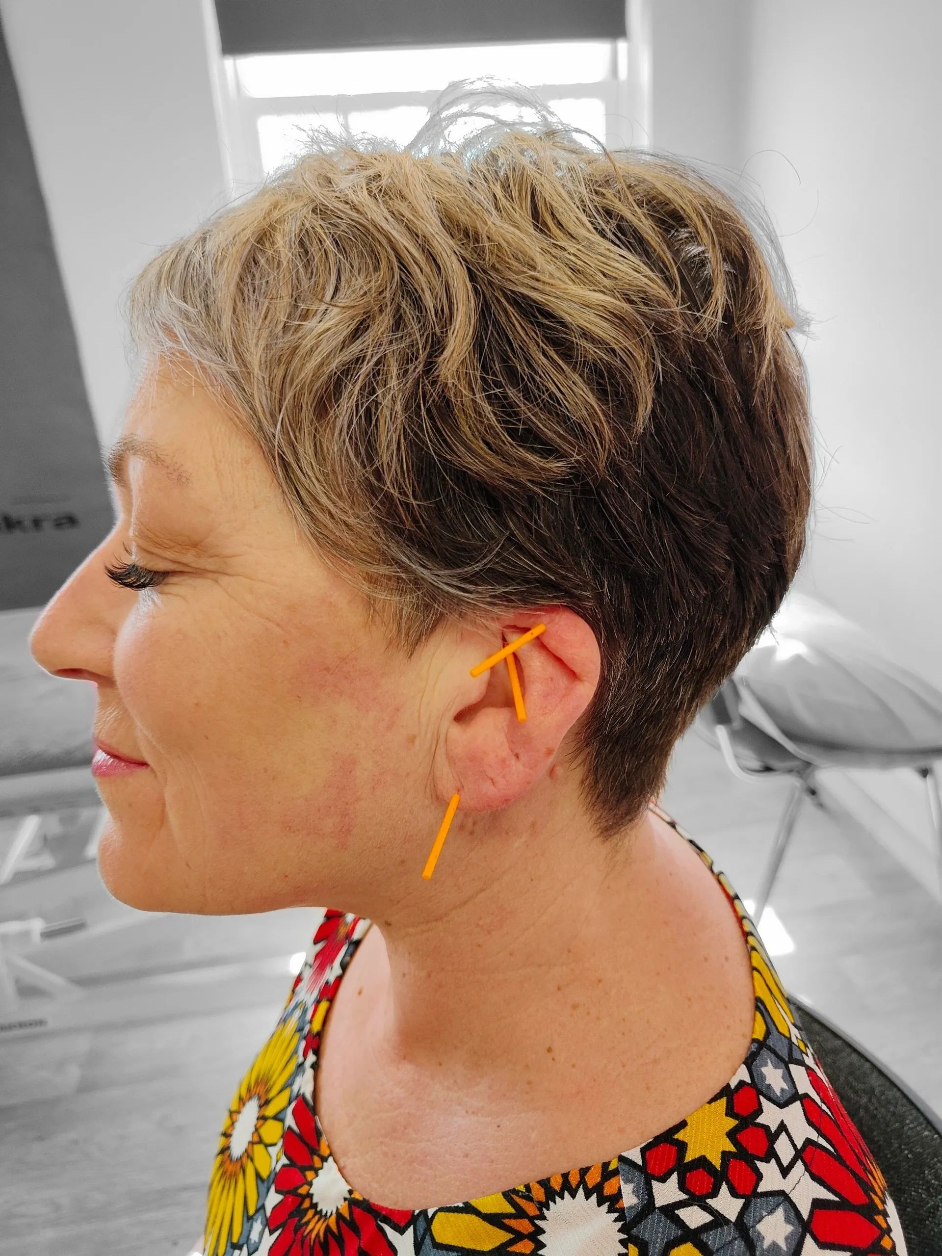 Relaxation, Reiki and NADA Protocol Auricular Therapy Acupuncture gift voucher