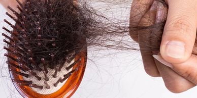 TELOGEN EFFLUVIUM Cayman Islands Hair Loss
