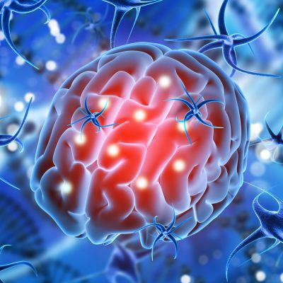 3D illustration of a brain with glowing neurons.