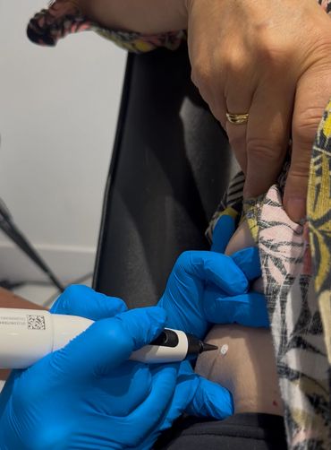 Medical professional using a device on a patient's arm with blue gloves.