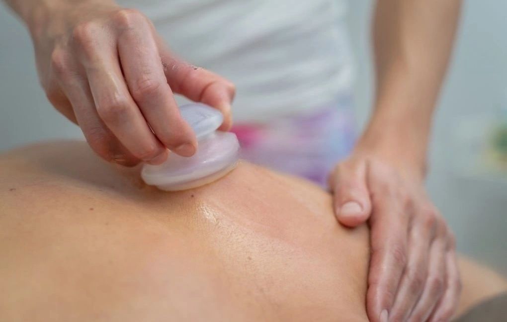 Professional therapist using silicone cups