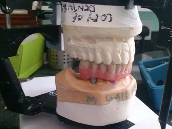 dental prosthetics services