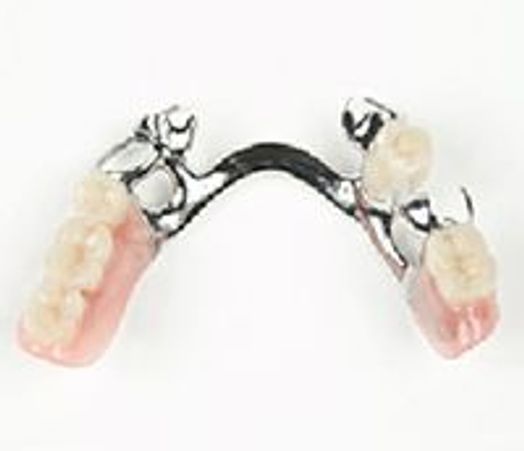 Chrome dentures