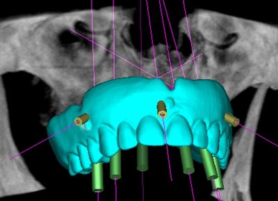 Planejamento 3D #odontologiadigital