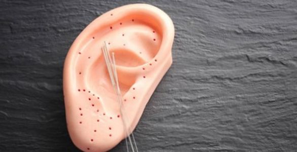 Auricular acupuncture, 耳针疗法