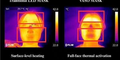Thermal Image comparison of LED Mask versus Vaso Mask