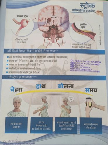 स्ट्रोक (Stroke)