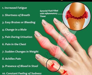 10 Symptoms of RA That You Should Not Ignore