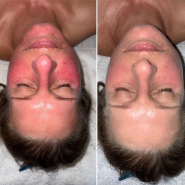 Jane Iredale After Glow, HydraFacial, SkinCeuticals