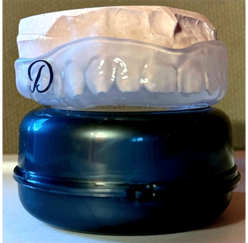 Dental mold with a clear retainer resting on a blue container.