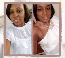 woman with vitiligo #BeautifulBothWaysCampaign